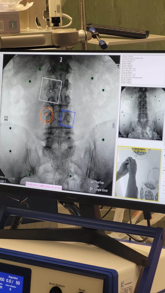 ULS Médio Tejo entre os primeiros hospitais europeus a utilizar tecnologia inovadora no tratamento da dor lombar crónica