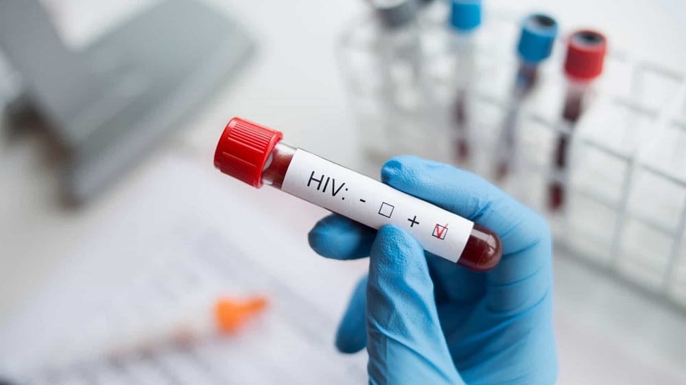 Mais de 60 Pontos de Rastreio do VIH disponíveis gratuitamente em Portugal